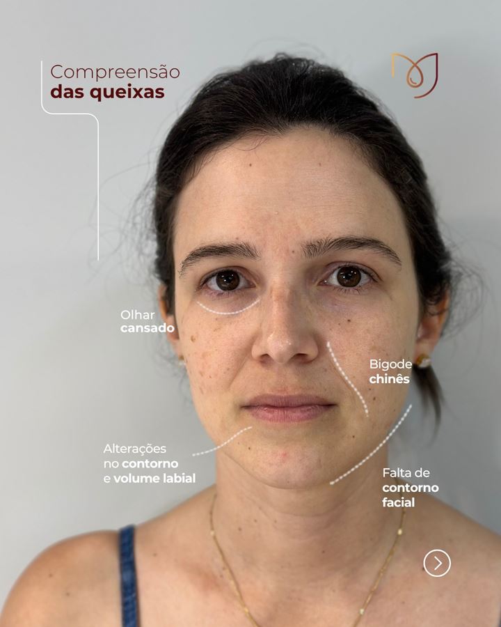 Arte da Dra. Mayara mostrando a compreensão das queixas no rosto de uma paciente